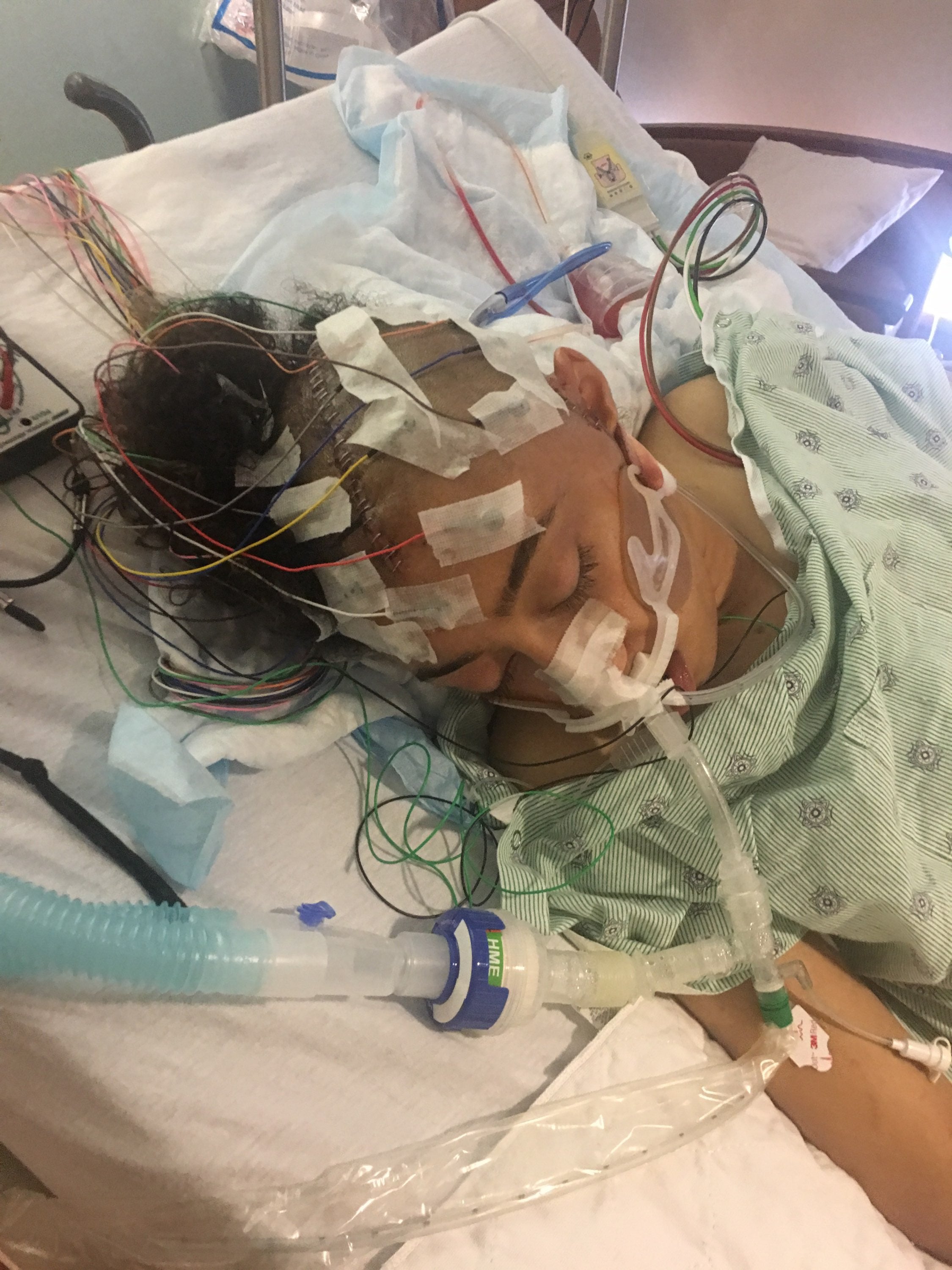 a person lying in a hospital bed with wires on their head